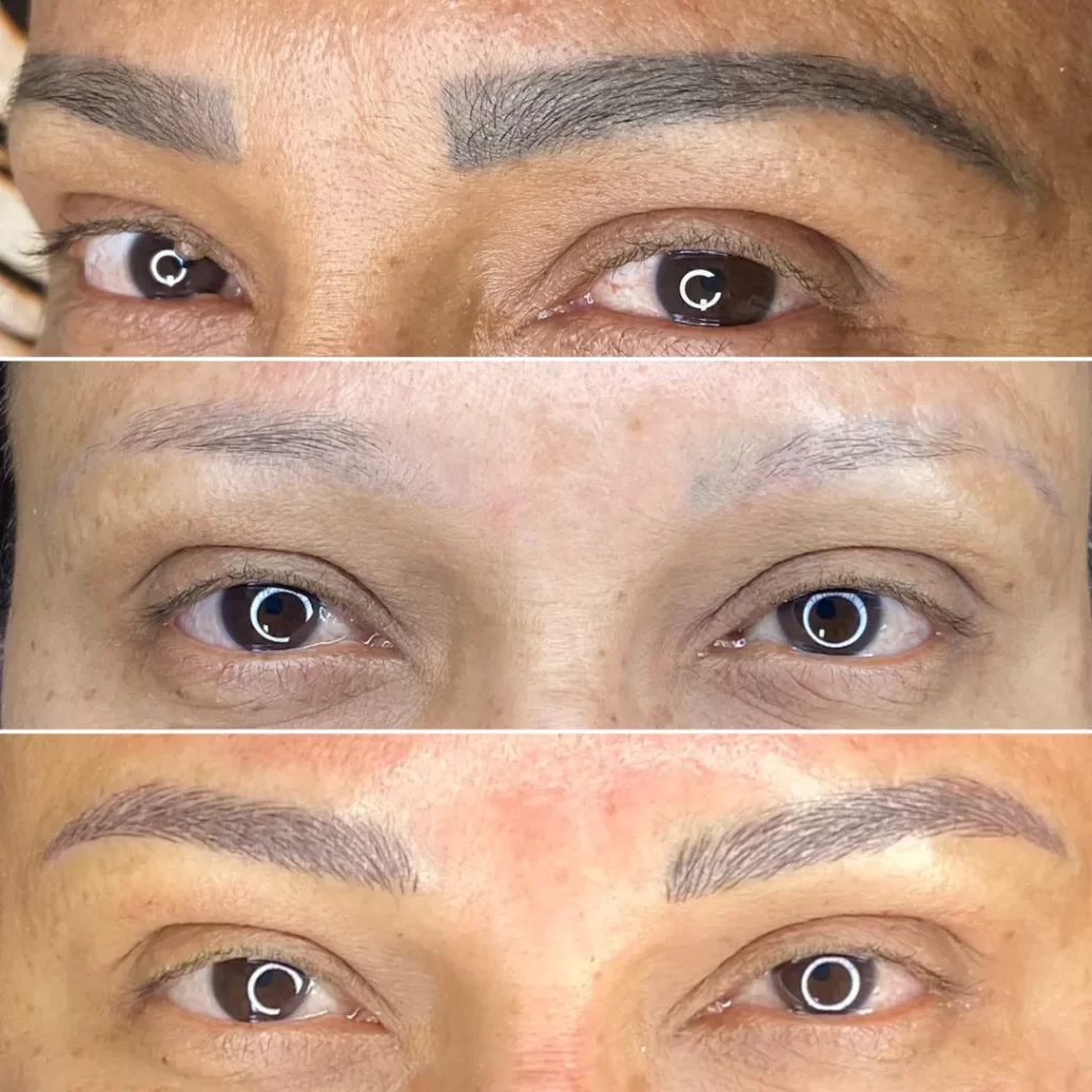 Remoção e Micropigmentação de sobrancelha por Tanara Miranda - Magnific Beauty