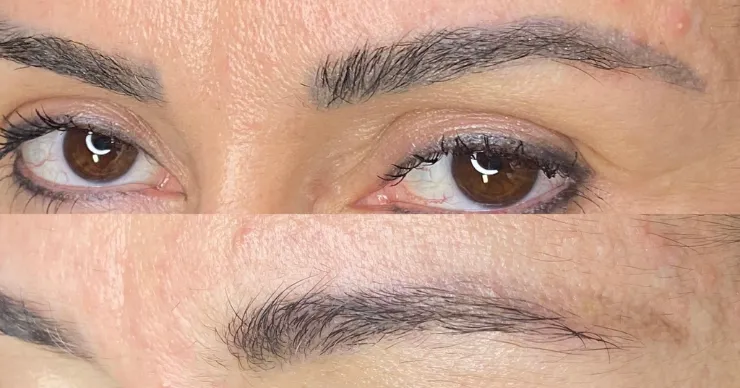 Remoção e Micropigmentação de sobrancelha por Tanara Miranda – Magnific Beauty Remoção e Micropigmentação de sobrancelha por Tanara Miranda - Magnific Beauty